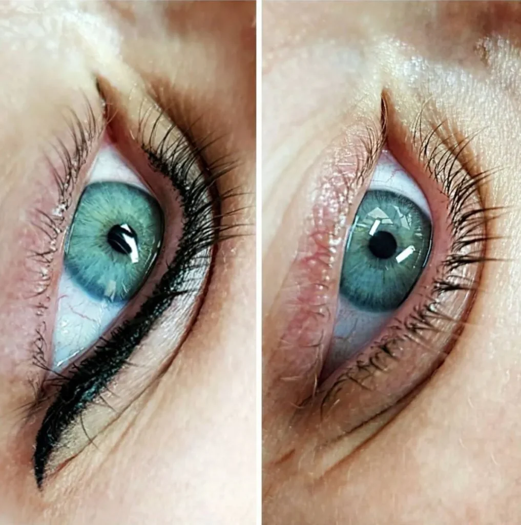 How to Get a Natural Result